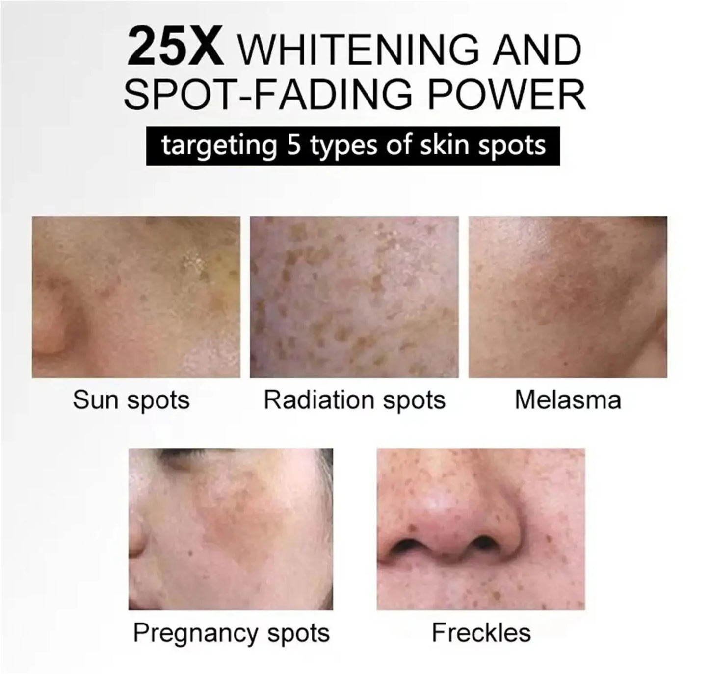 Powerful Dark Spots Remover Whitening Serum Face Freckle Melanin Correcting Anti Pigmentation Brighten Skin Beauty Care Essence