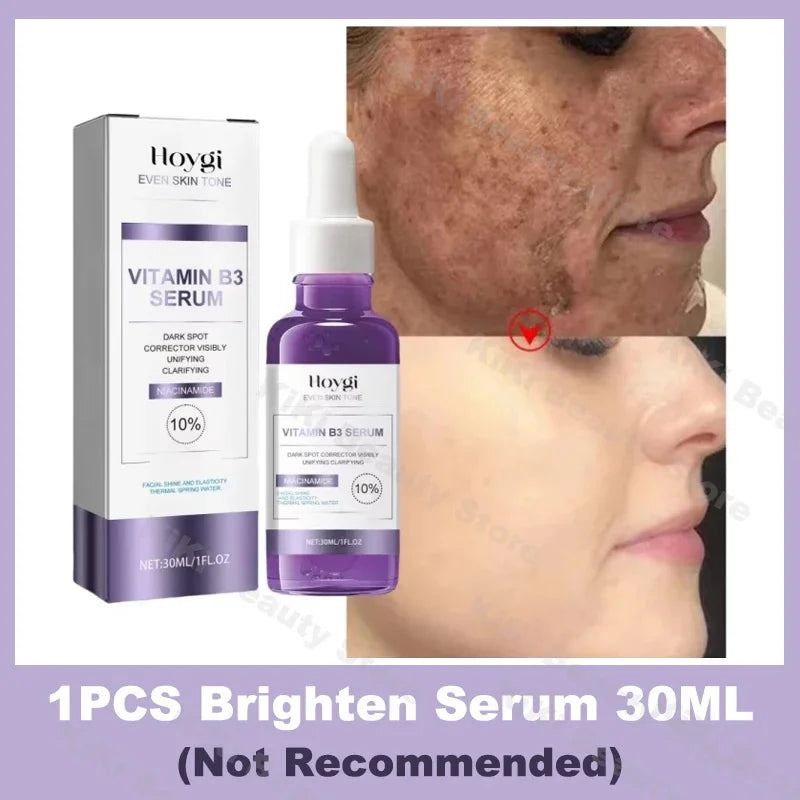 Powerful Dark Spots Remover Whitening Serum Face Freckle Melanin Correcting Anti Pigmentation Brighten Skin Beauty Care Essence